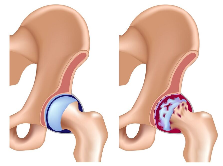 Healthy joints and hips